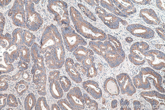 TRUB2 Antibody in Immunohistochemistry (Paraffin) (IHC (P))