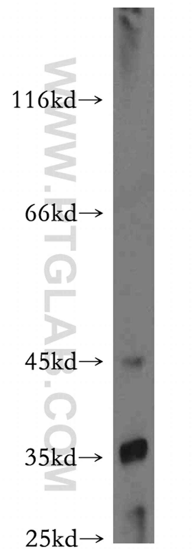 TRUB2 Antibody in Western Blot (WB)