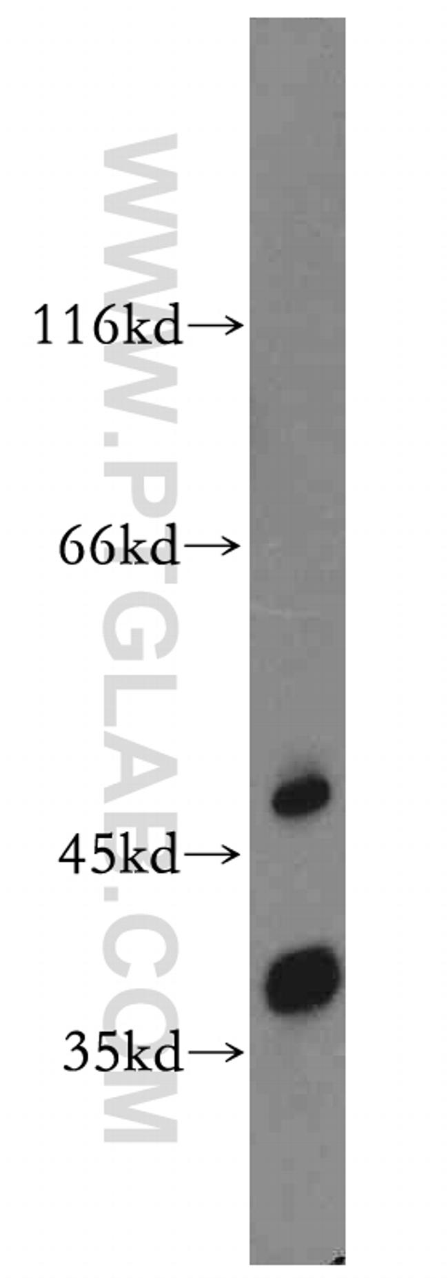 TRUB2 Antibody in Western Blot (WB)