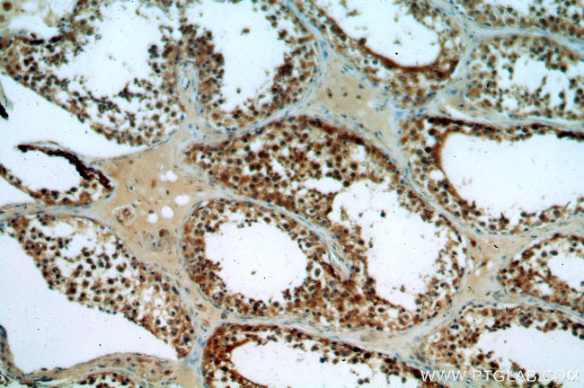 ASUN Antibody in Immunohistochemistry (Paraffin) (IHC (P))