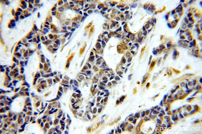 ASUN Antibody in Immunohistochemistry (Paraffin) (IHC (P))