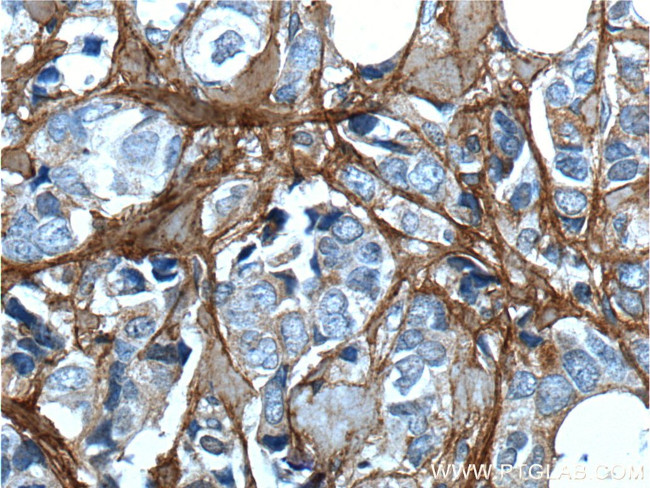 Periostin Antibody in Immunohistochemistry (Paraffin) (IHC (P))