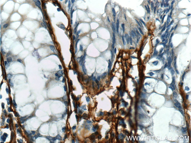 Periostin Antibody in Immunohistochemistry (Paraffin) (IHC (P))