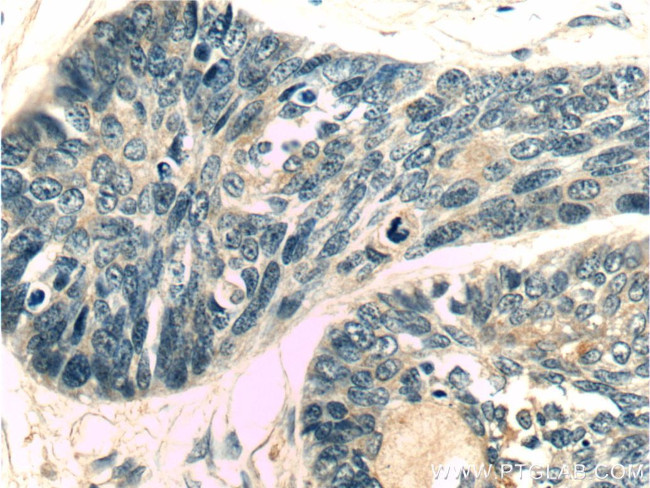 C11orf79 Antibody in Immunohistochemistry (Paraffin) (IHC (P))