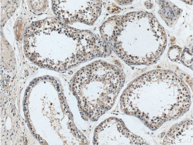 C11orf79 Antibody in Immunohistochemistry (Paraffin) (IHC (P))