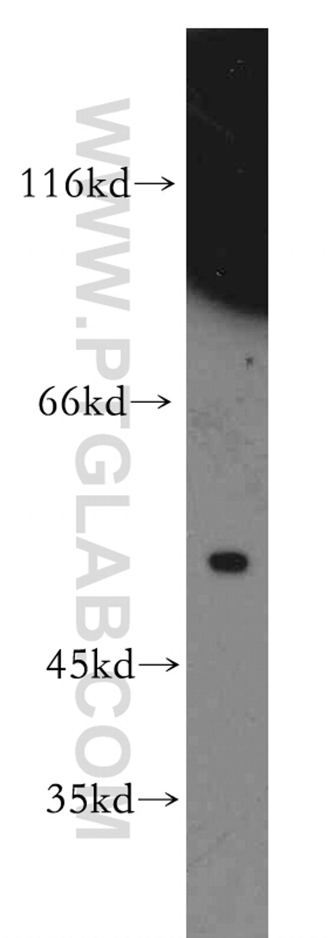 SLC10A3 Antibody in Western Blot (WB)