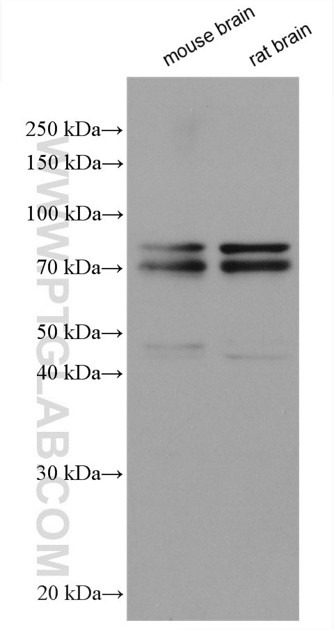 DDX17 Antibody in Western Blot (WB)