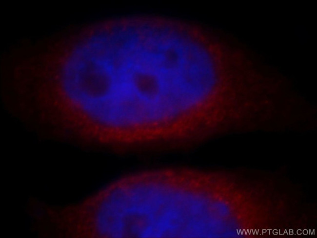 C20orf149 Antibody in Immunocytochemistry (ICC/IF)