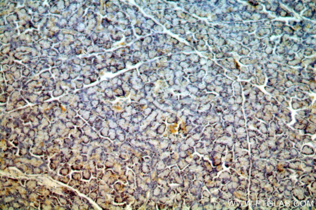 C20orf149 Antibody in Immunohistochemistry (Paraffin) (IHC (P))