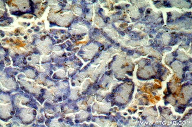 C20orf149 Antibody in Immunohistochemistry (Paraffin) (IHC (P))