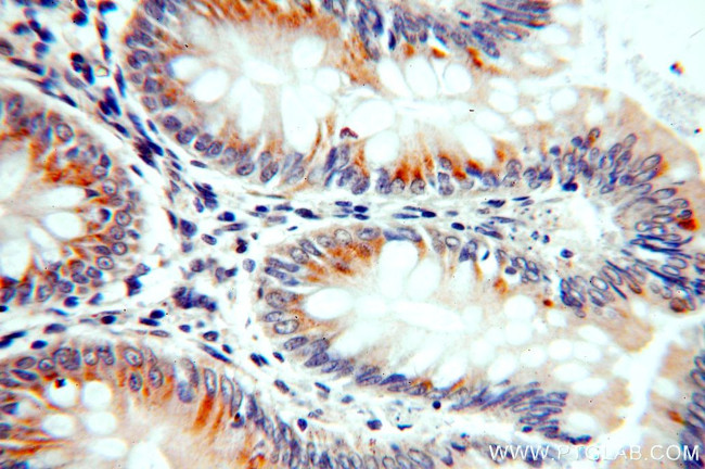 C20orf149 Antibody in Immunohistochemistry (Paraffin) (IHC (P))