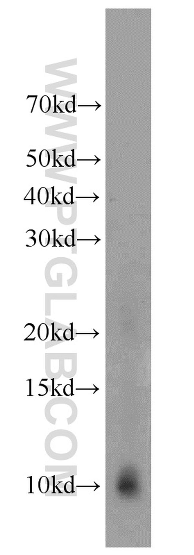 C20orf149 Antibody in Western Blot (WB)