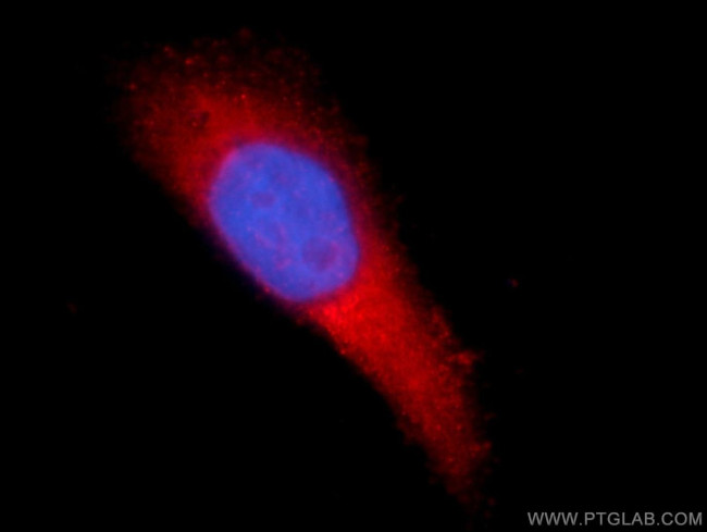 TMEM38B Antibody in Immunocytochemistry (ICC/IF)