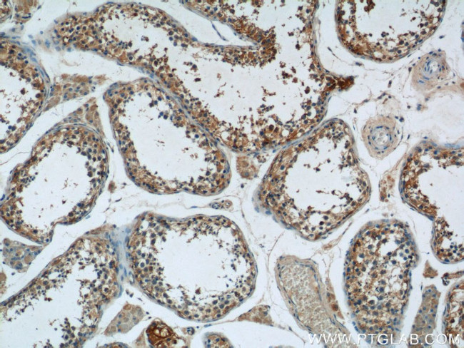 TMEM38B Antibody in Immunohistochemistry (Paraffin) (IHC (P))