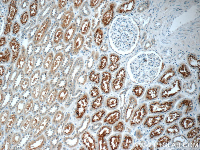 TMEM38B Antibody in Immunohistochemistry (Paraffin) (IHC (P))