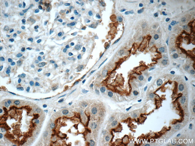 TMEM38B Antibody in Immunohistochemistry (Paraffin) (IHC (P))