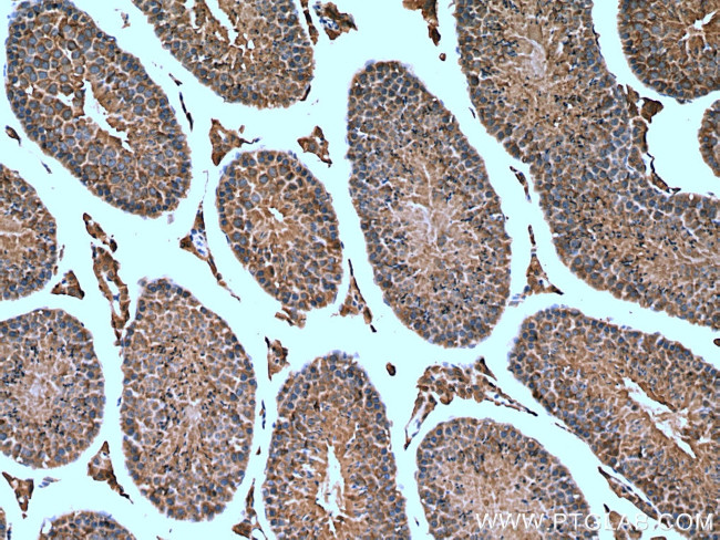 TMEM38B Antibody in Immunohistochemistry (Paraffin) (IHC (P))