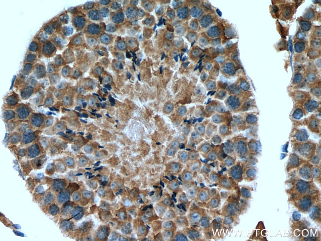 TMEM38B Antibody in Immunohistochemistry (Paraffin) (IHC (P))