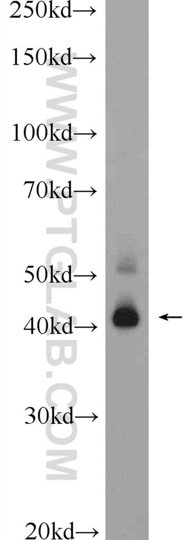 TMEM38B Antibody in Western Blot (WB)