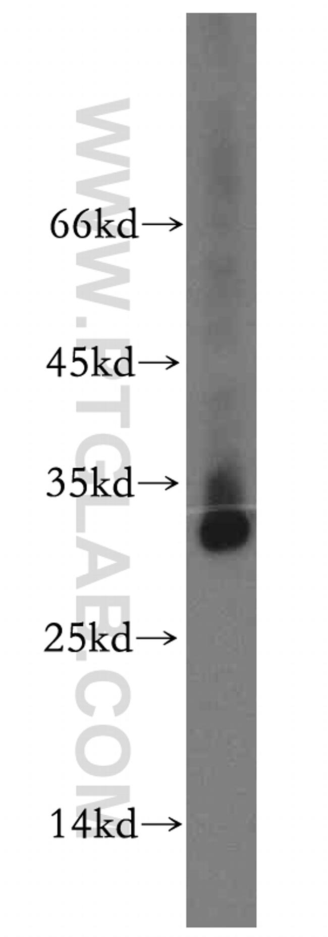 TMEM38A Antibody in Western Blot (WB)