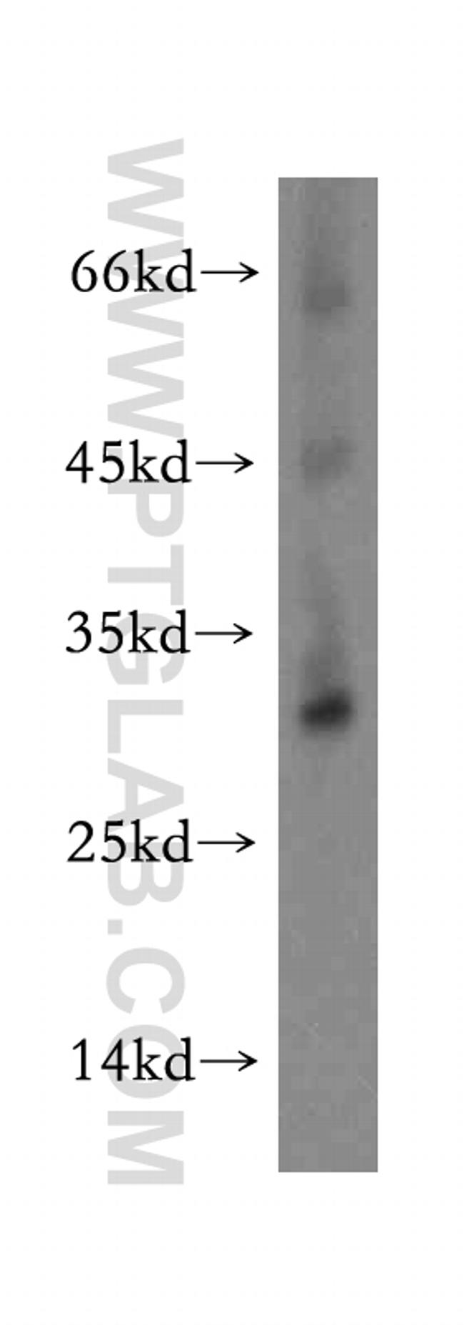 TMEM38A Antibody in Western Blot (WB)