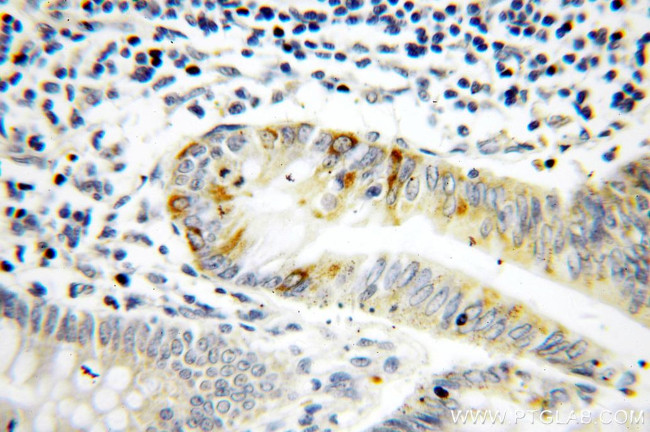 METT10D Antibody in Immunohistochemistry (Paraffin) (IHC (P))