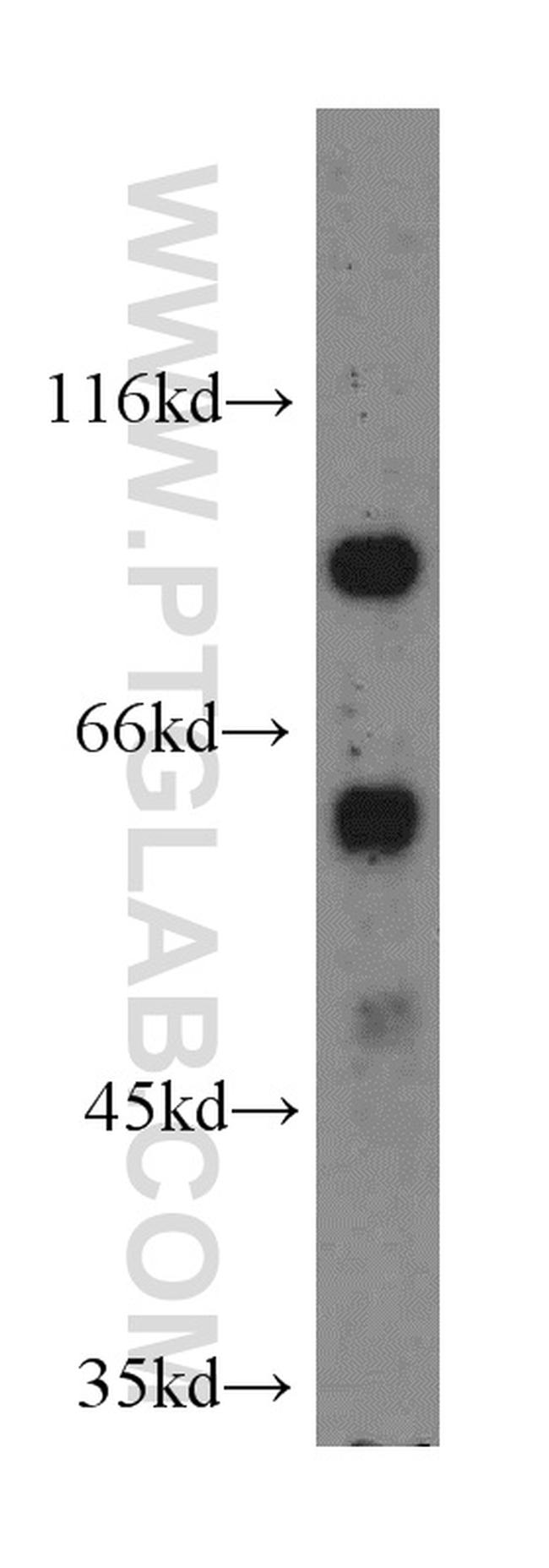 METT10D Antibody in Western Blot (WB)