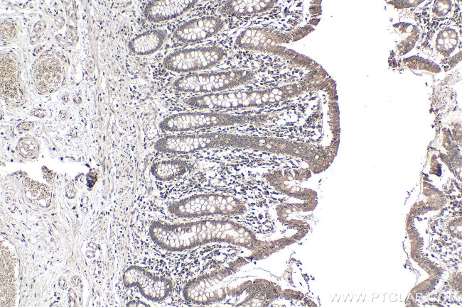 METT10D Antibody in Immunohistochemistry (Paraffin) (IHC (P))