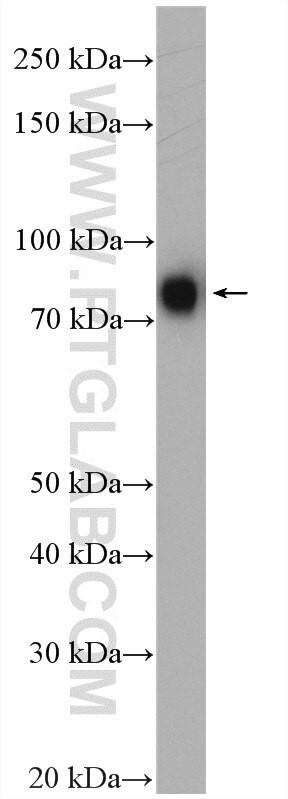 METT10D Antibody in Western Blot (WB)