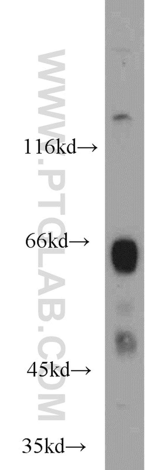 METT10D Antibody in Western Blot (WB)