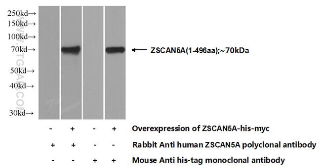 ZSCAN5A Antibody in Western Blot (WB)