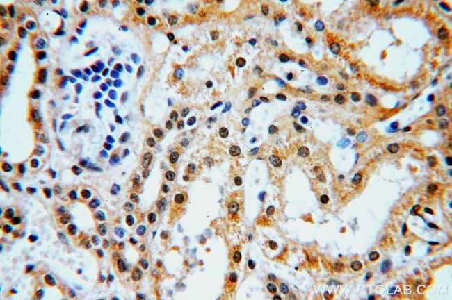 HEY1 Antibody in Immunohistochemistry (Paraffin) (IHC (P))