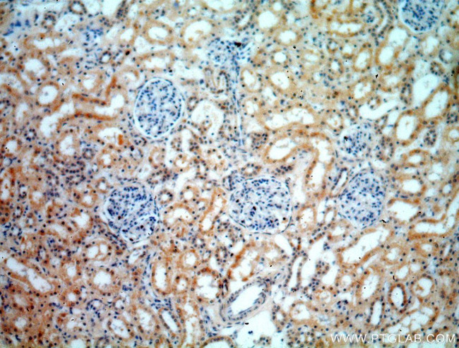 HEY1 Antibody in Immunohistochemistry (Paraffin) (IHC (P))