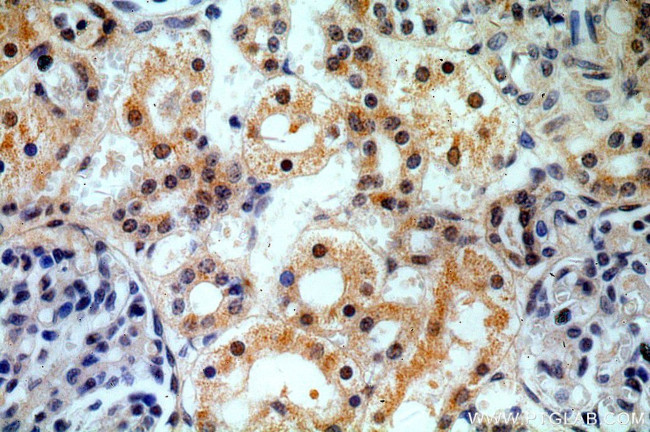 HEY1 Antibody in Immunohistochemistry (Paraffin) (IHC (P))