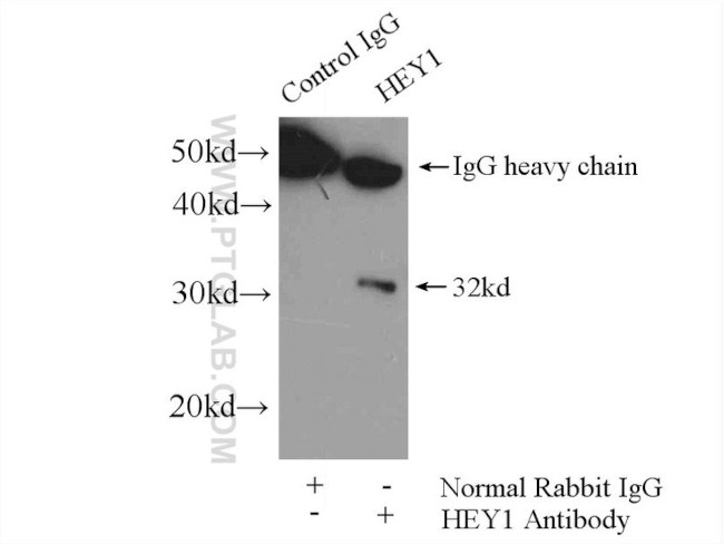 HEY1 Antibody in Immunoprecipitation (IP)