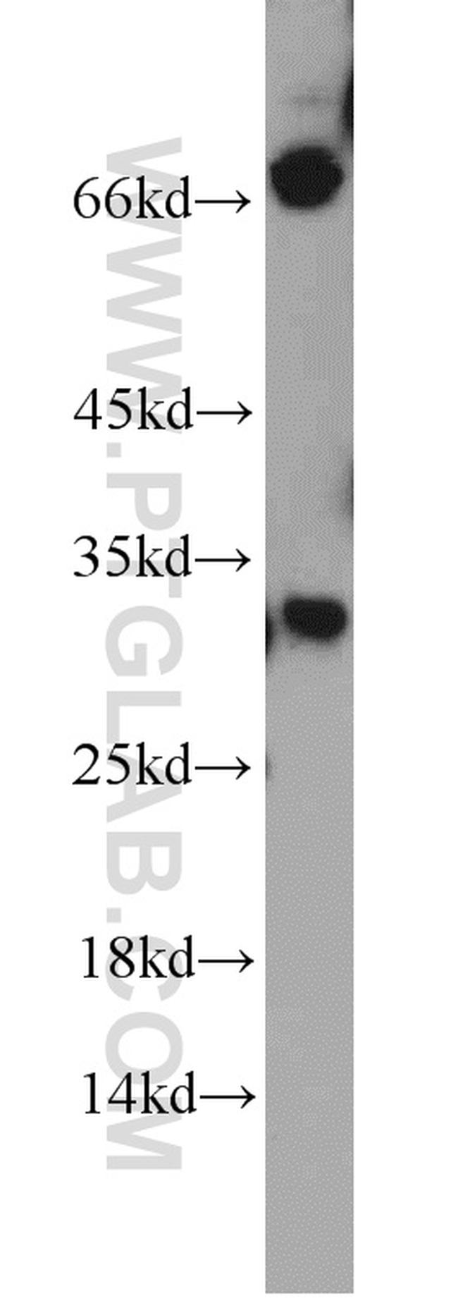 HEY1 Antibody in Western Blot (WB)