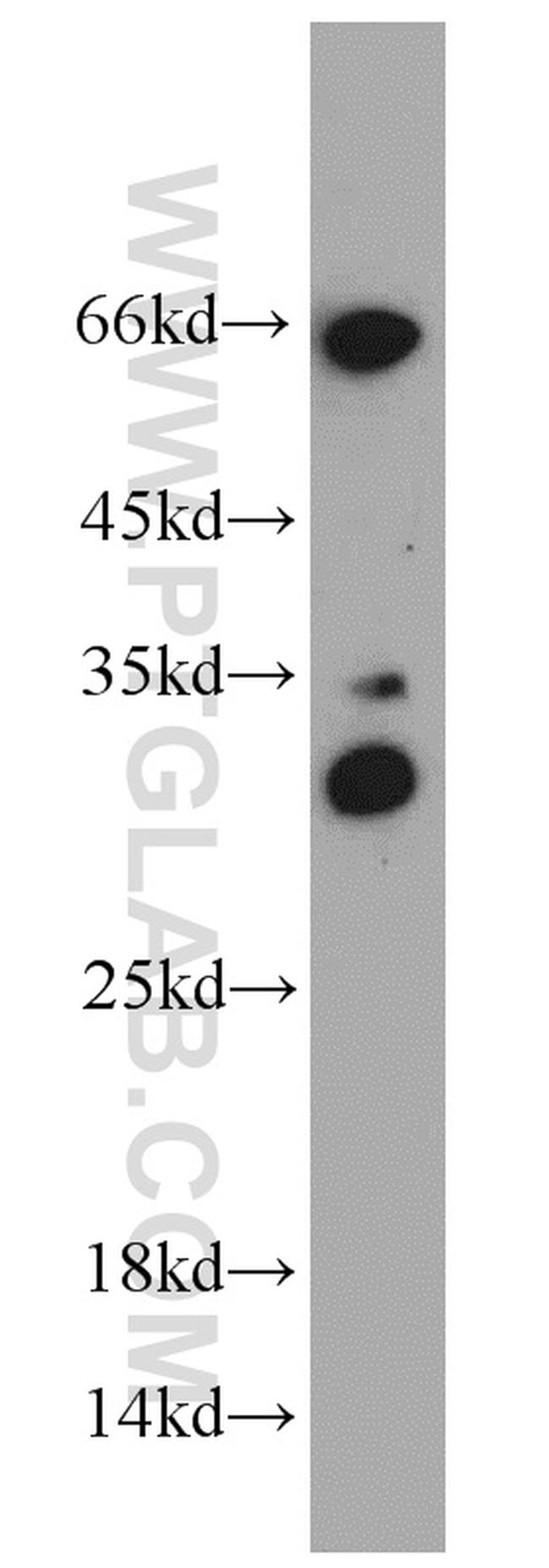 HEY1 Antibody in Western Blot (WB)