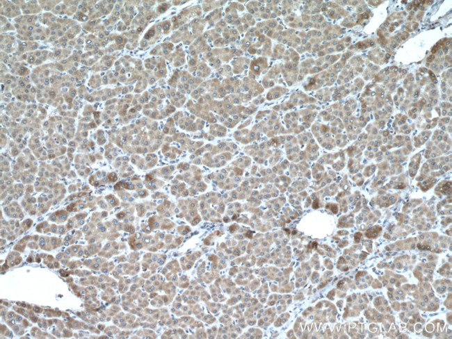 CYP2E1 Antibody in Immunohistochemistry (Paraffin) (IHC (P))