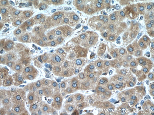 CYP2E1 Antibody in Immunohistochemistry (Paraffin) (IHC (P))