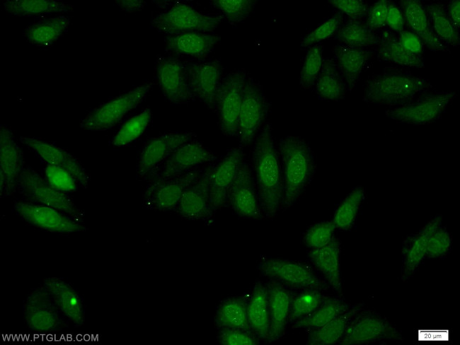 ERBB4 Antibody in Immunocytochemistry (ICC/IF)