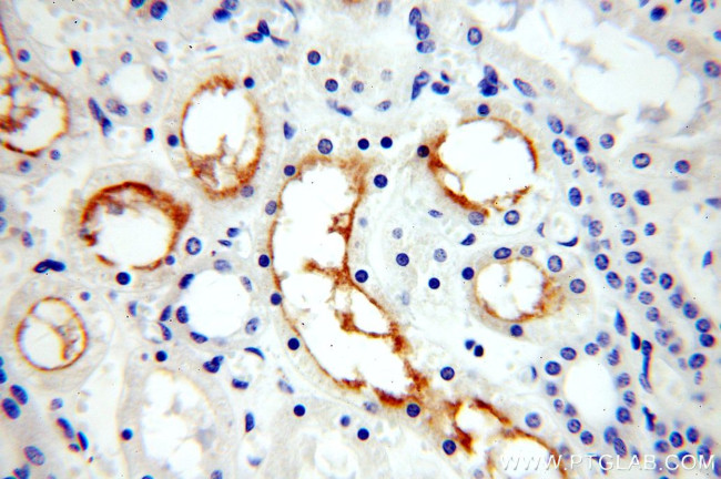 ERBB4 Antibody in Immunohistochemistry (Paraffin) (IHC (P))