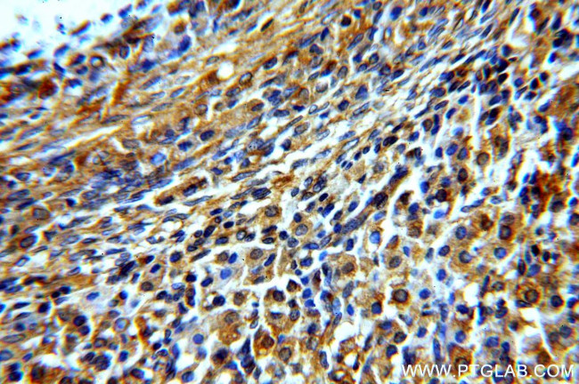 GNRHR Antibody in Immunohistochemistry (Paraffin) (IHC (P))