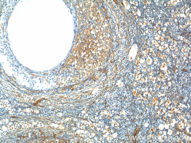 GNRHR Antibody in Immunohistochemistry (Paraffin) (IHC (P))