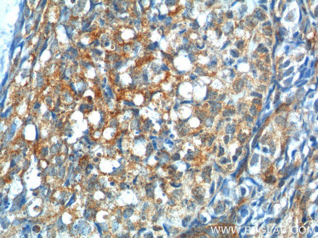 GNRHR Antibody in Immunohistochemistry (Paraffin) (IHC (P))