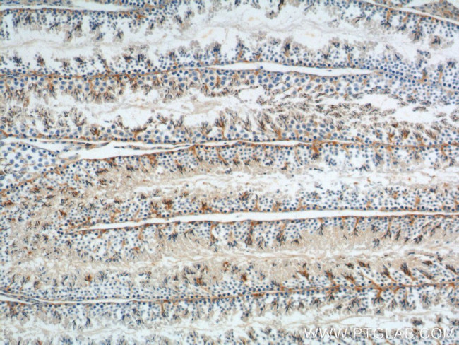 GNRHR Antibody in Immunohistochemistry (Paraffin) (IHC (P))