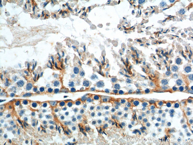 GNRHR Antibody in Immunohistochemistry (Paraffin) (IHC (P))