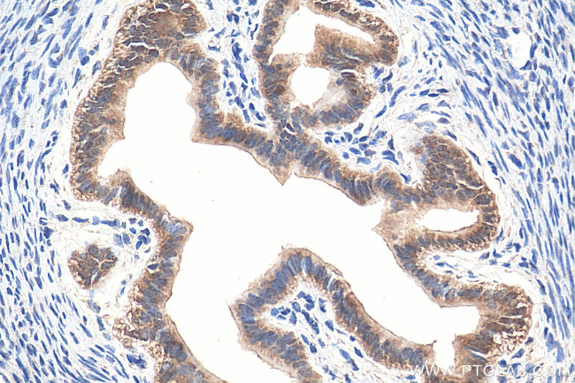 GNRHR Antibody in Immunohistochemistry (Paraffin) (IHC (P))