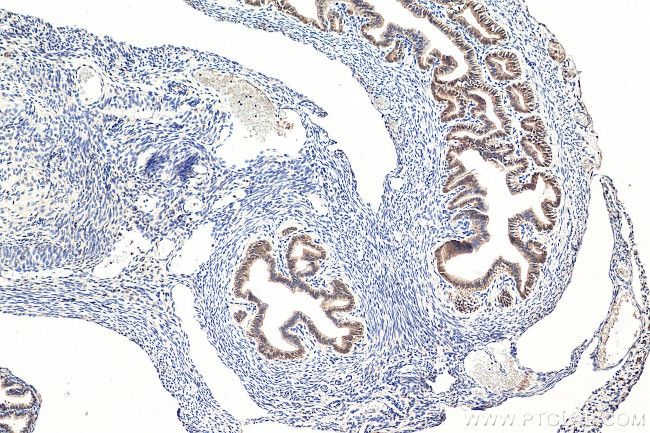 GNRHR Antibody in Immunohistochemistry (Paraffin) (IHC (P))