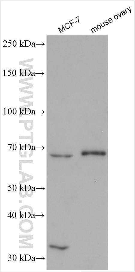 GNRHR Antibody in Western Blot (WB)