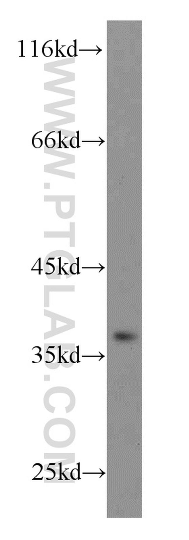 GNRHR Antibody in Western Blot (WB)